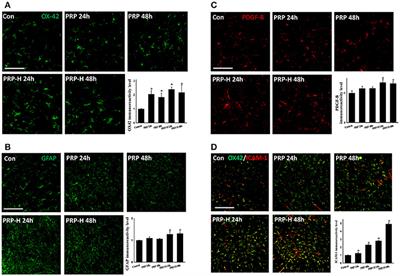 Therapeutic Effect of Platelet-Rich Plasma in Rat Spinal Cord Injuries